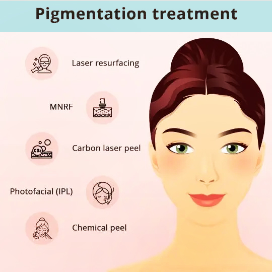 How can Hyperpigmentation be Treated? - Types of Pigmentation Treatment in Indore: Laser Resurfacing, MNRF , Carbon Laser Peel